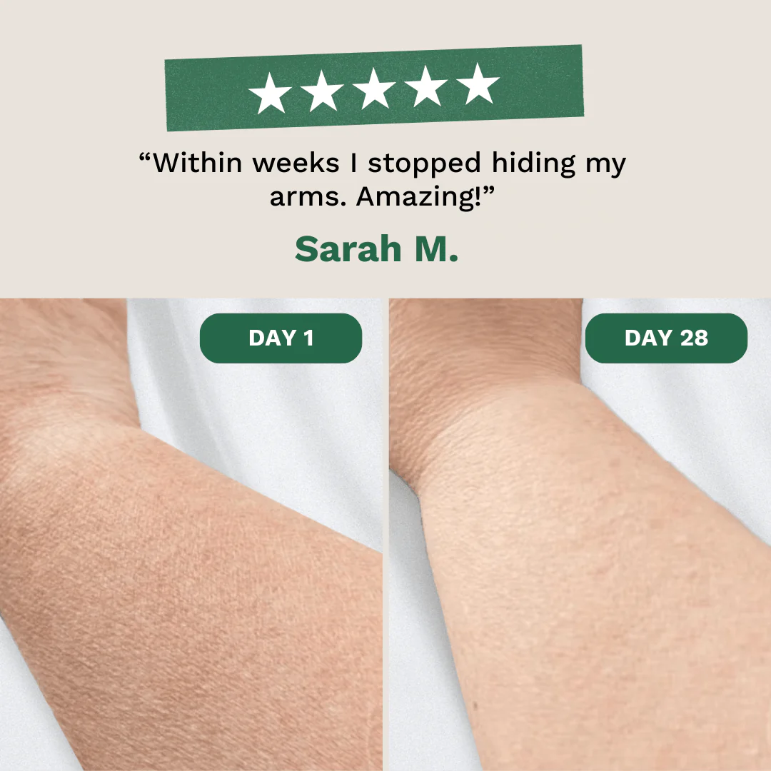 Crepey Skin Repair Cream - Image 11