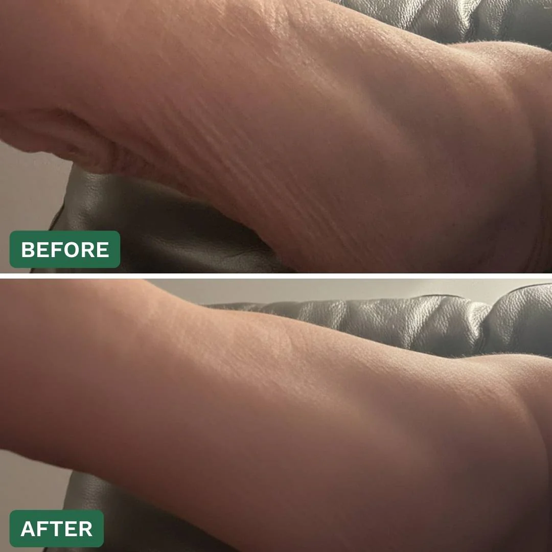 Crepey Skin Repair Cream - Image 13