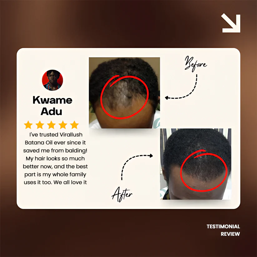 Batana Natural Hair Growth Oil 2.0 - Image 10