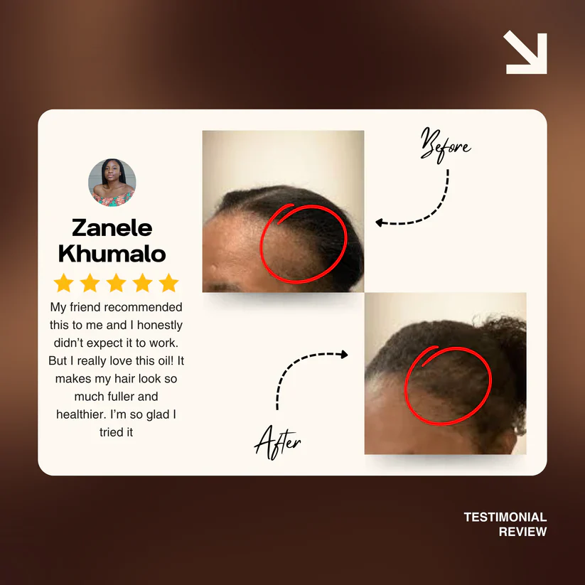Batana Natural Hair Growth Oil 2.0 - Image 7