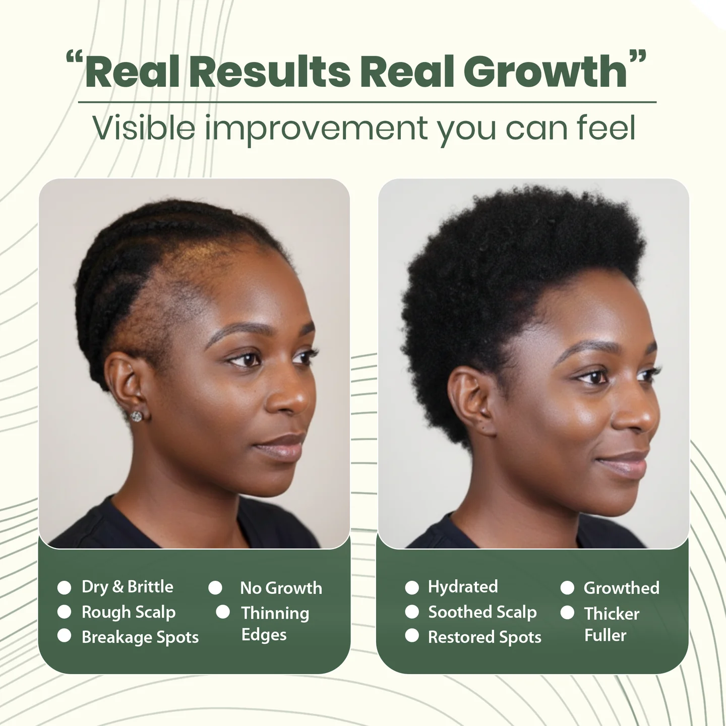 Batana Natural Hair Growth Oil - Image 2