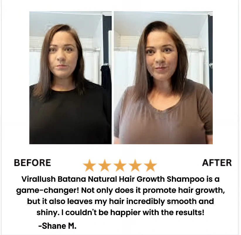 Batana Natural Hair Growth Shampoo - Image 5