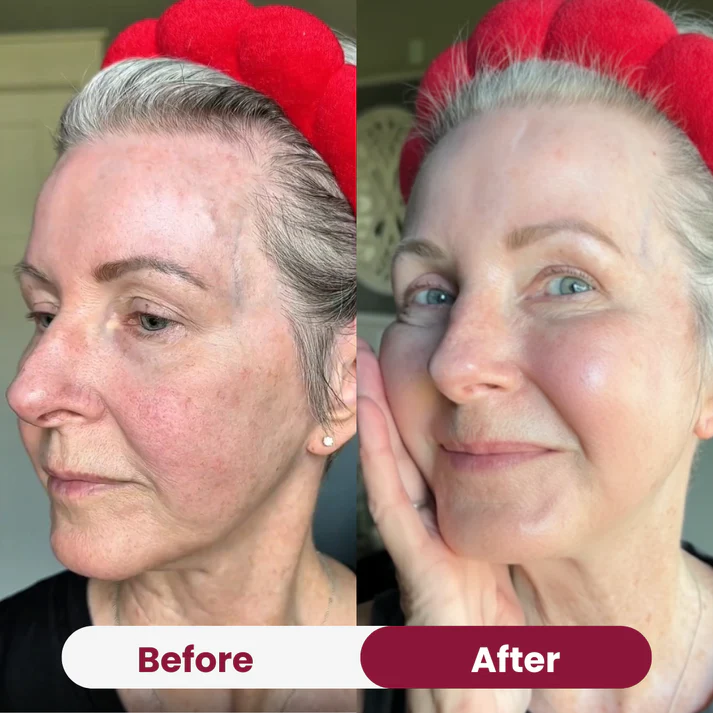 Bio-Collagen Mask 2.0 - Image 2