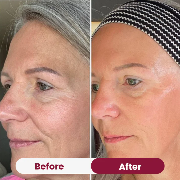 Bio-Collagen Mask 2.0 - Image 5