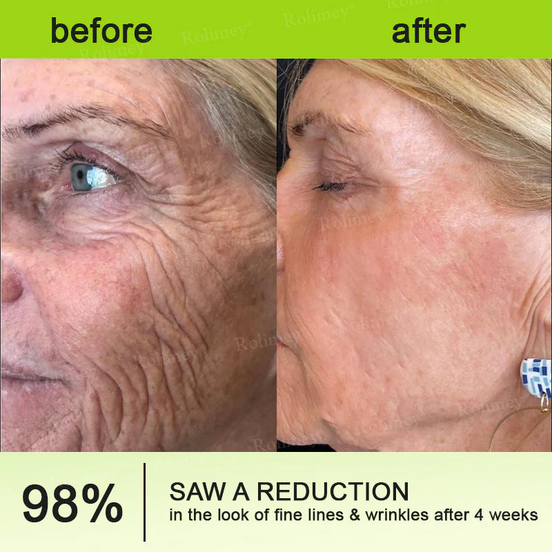 🔥Final 3 Hours: 70%OFF🔥 Botulinum & Vita-A Retinol Shot Wrinkle-Lift Tightening cream✨ - Image 7