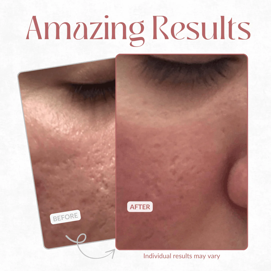 ✨CACTOX Pore Relief Multi Balm - Image 3