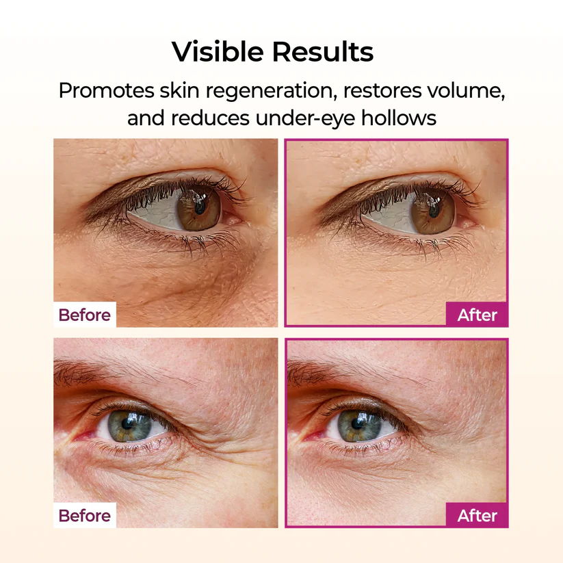 Calcium Volume Multi Balm+Eye Patch 60ea | Anti-Aging Skincare - Image 6