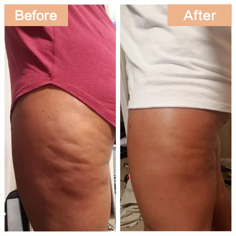 Age-Defying Revival Collagen & Stem Cell Body Oil - Image 7