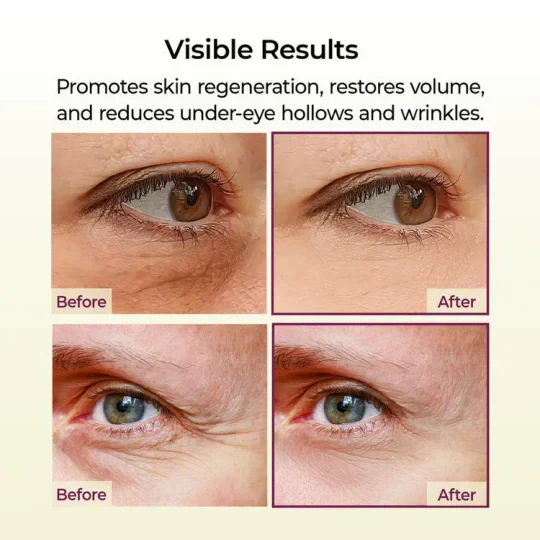 Transform Wrinkles, Fine Lines, And Tired Creases Naturally - Image 3