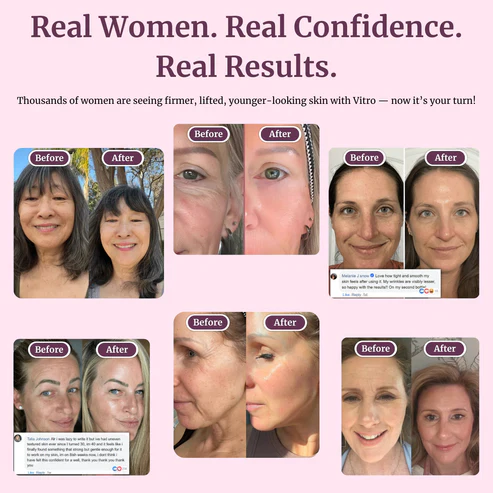 Transform Wrinkles, Fine Lines, And Tired Creases Naturally - Image 4