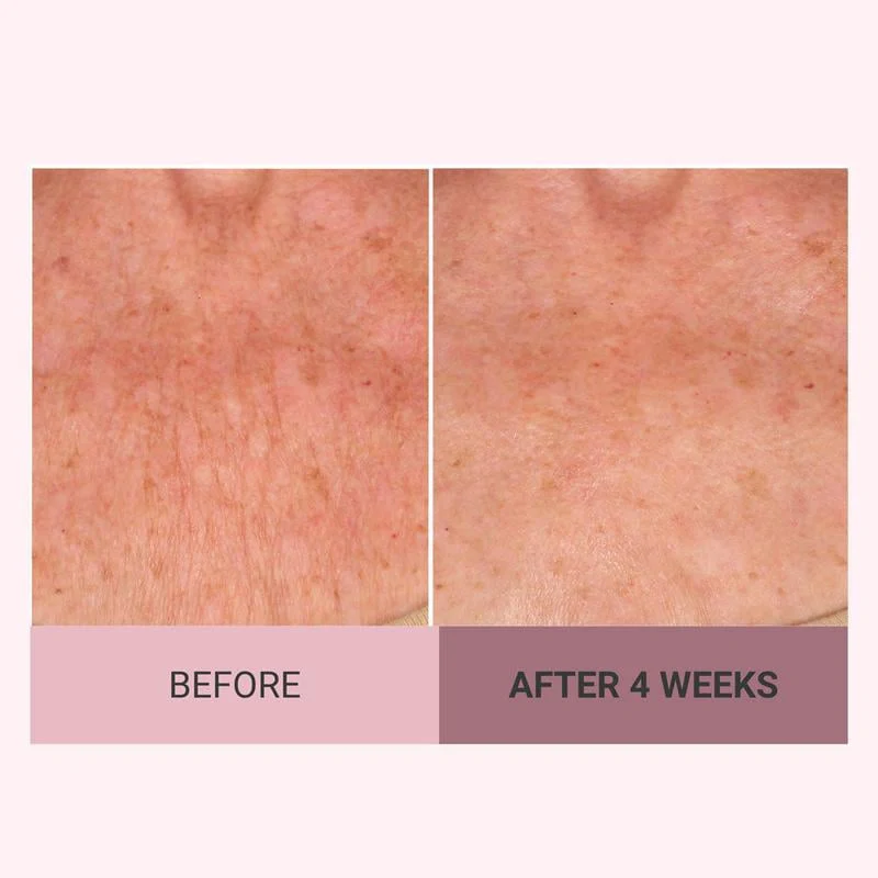 Consult Beaute Champagne Beaute Lift Firming Body Crème - Image 5
