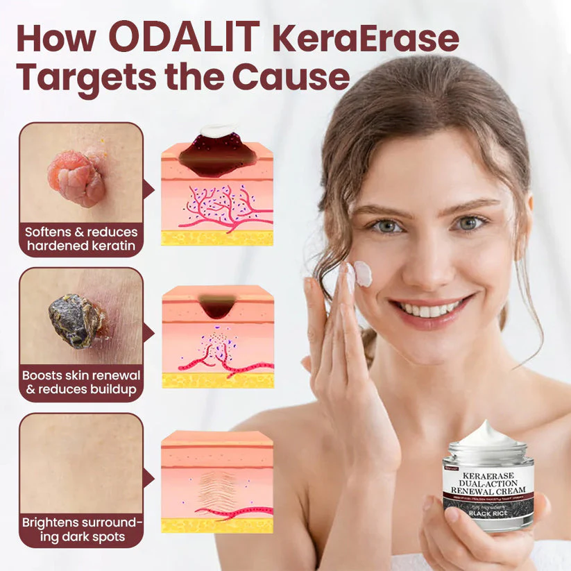 ✅Flash Sale - KeraErase Dual-Action Renewal Cream - Image 2