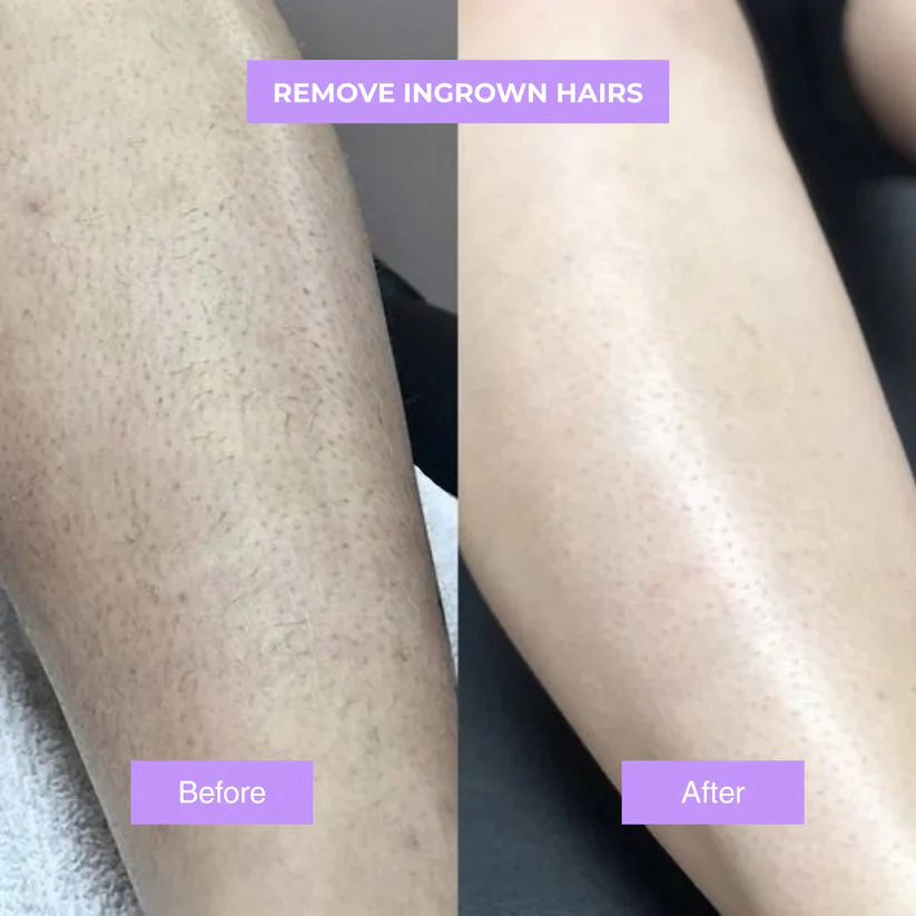 Viralaluna™ - Cyperus Rotundus Skin Serum - Image 5