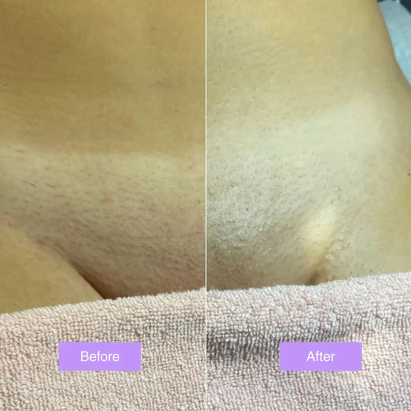 Viralaluna™ - Cyperus Rotundus Skin Serum - Image 6