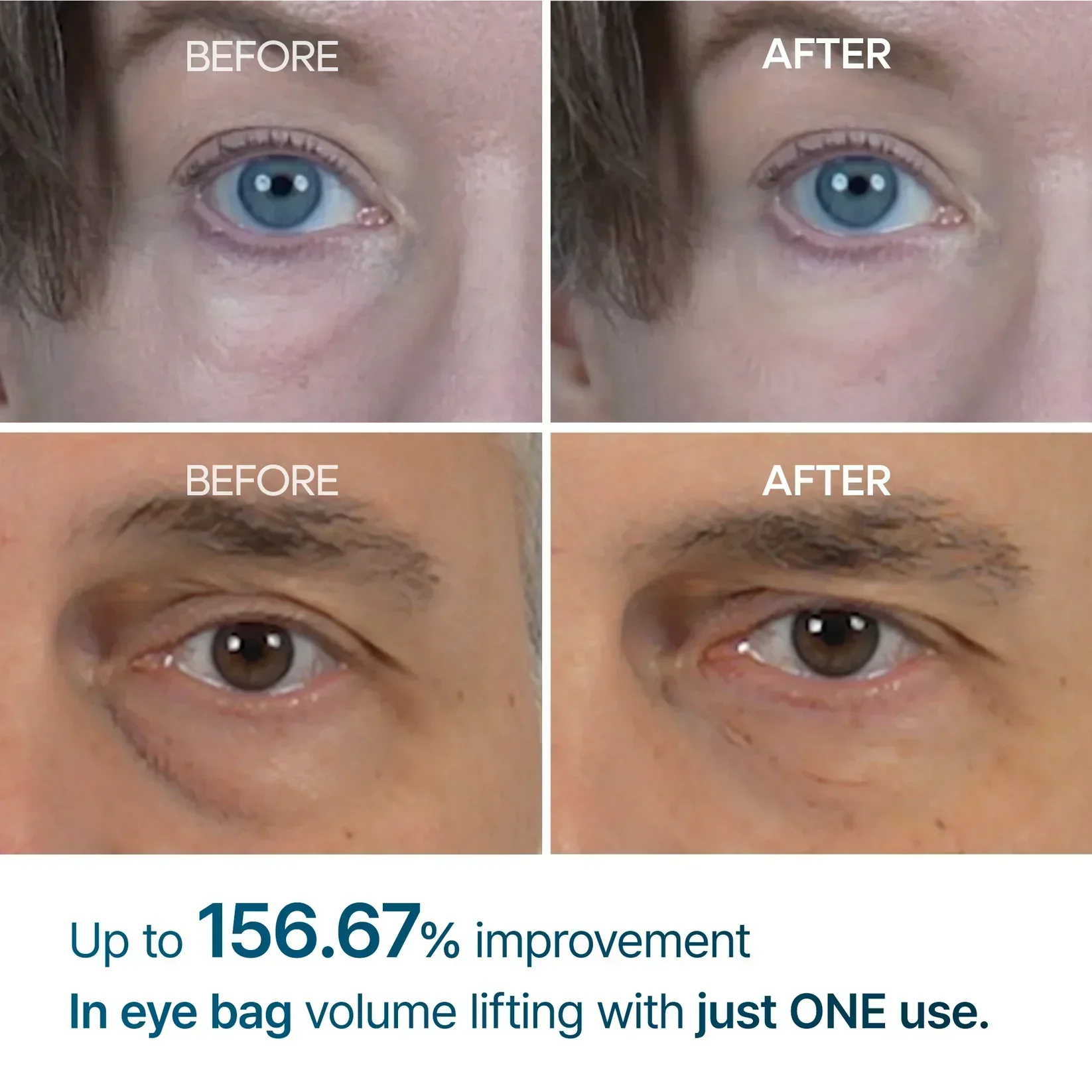 Eyebag Remover Cream - Image 3
