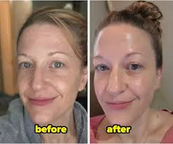 Eyebag Remover Cream - Image 5