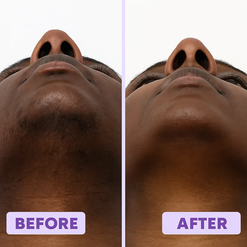 Facial Hair Removal Cream - Image 3