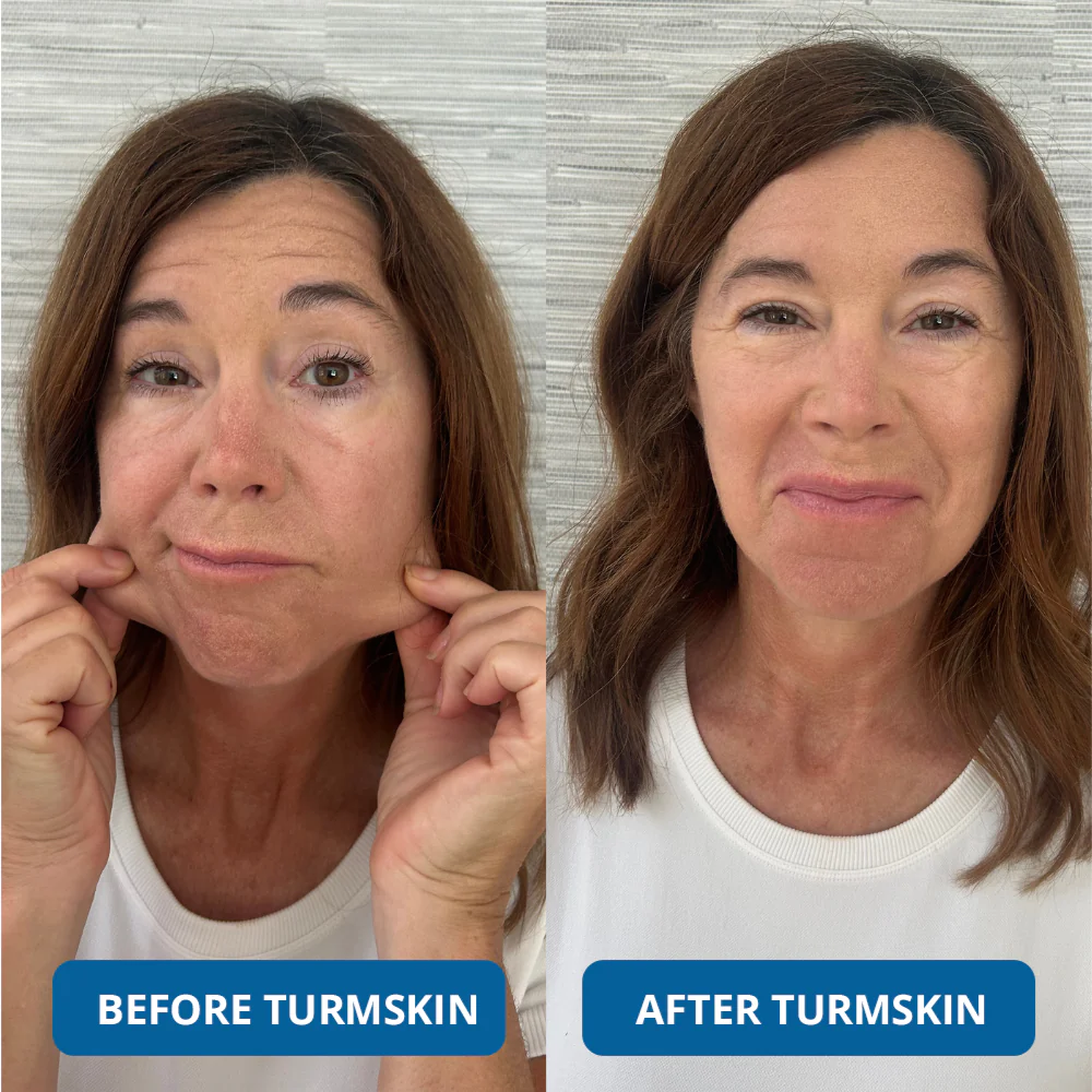 3% Hyaluronic Acid Ultra Hydrating Serum - Image 2