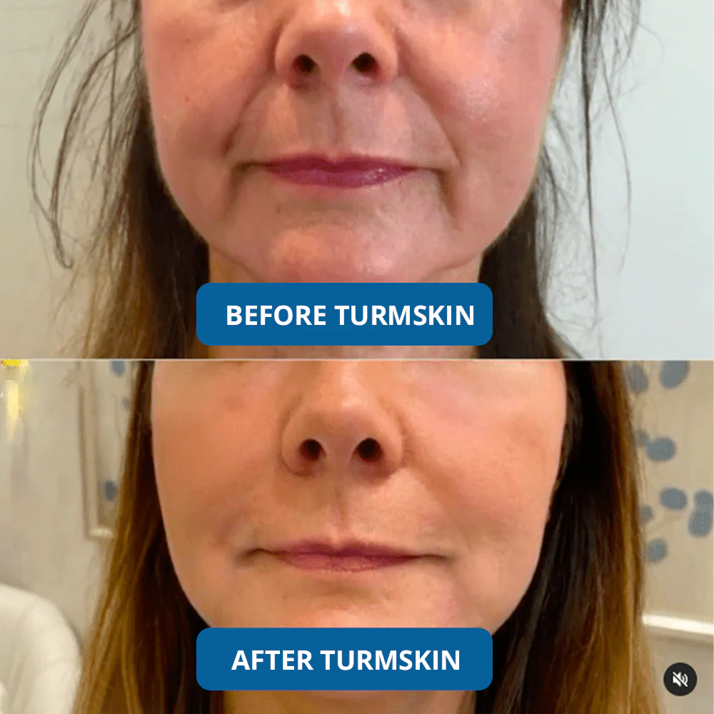 3% Hyaluronic Acid Ultra Hydrating Serum - Image 4