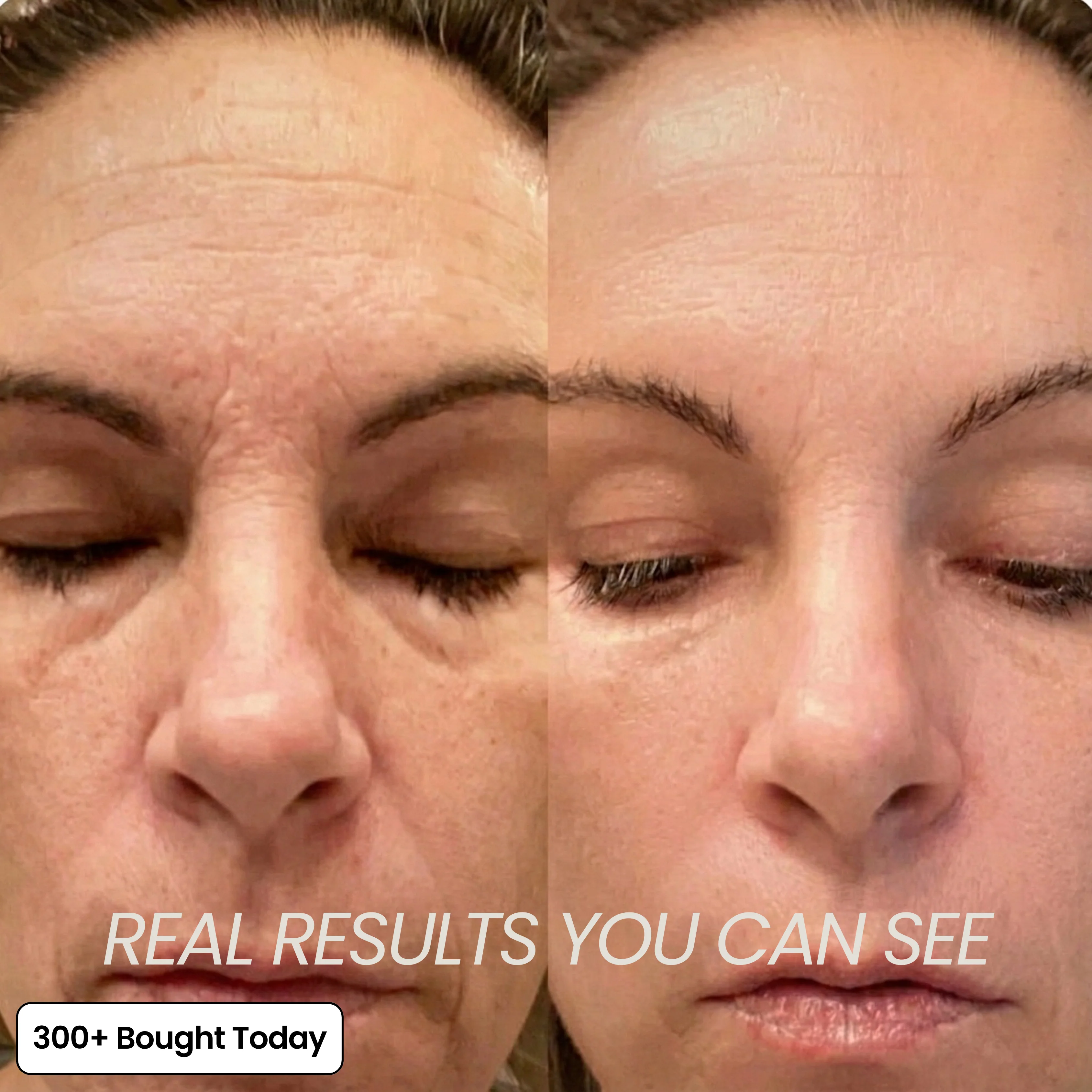 Transform Wrinkles, Fine Lines, And Tired Creases Naturally - Image 5