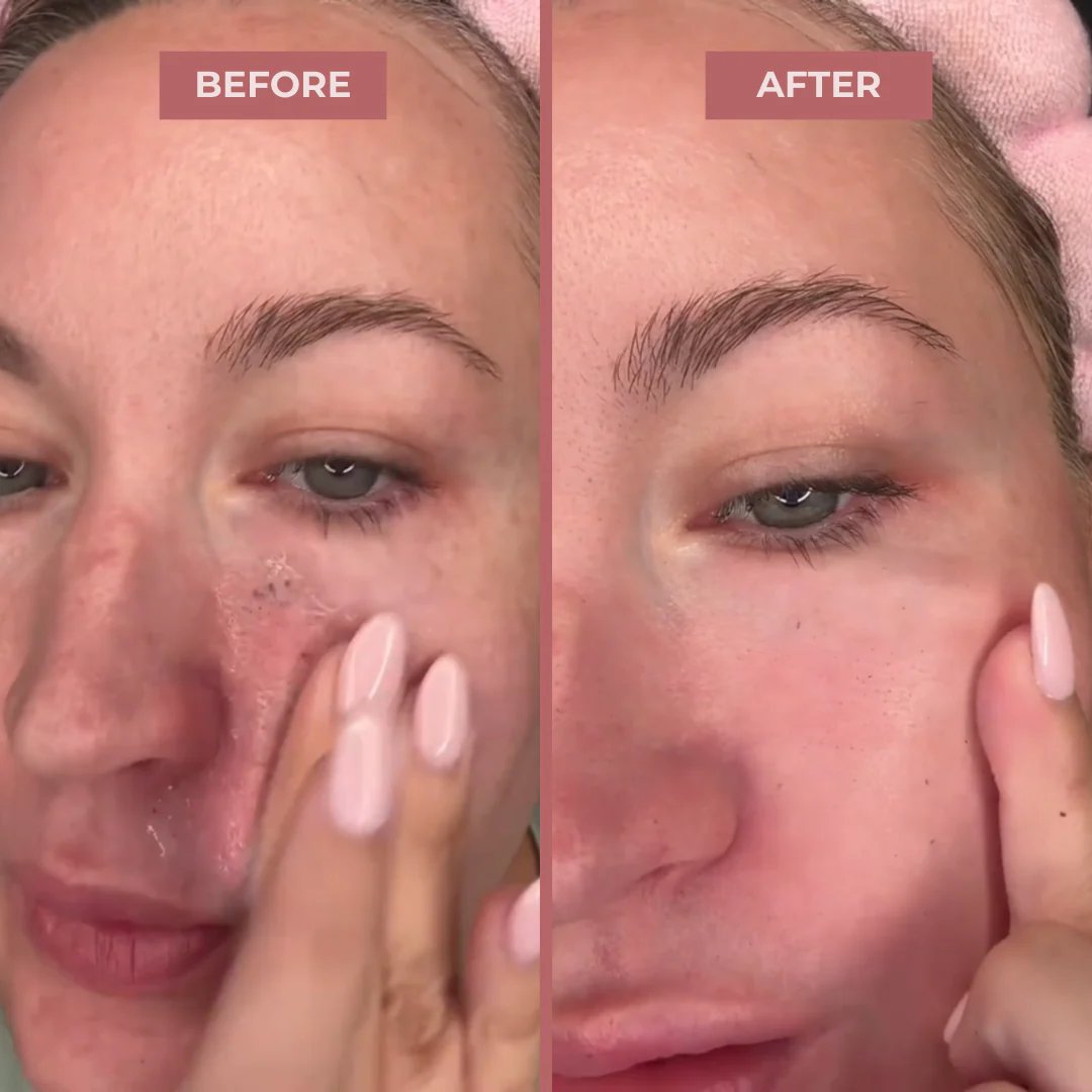 Peel Shot Glow Rice Ampoule Duo - Image 7