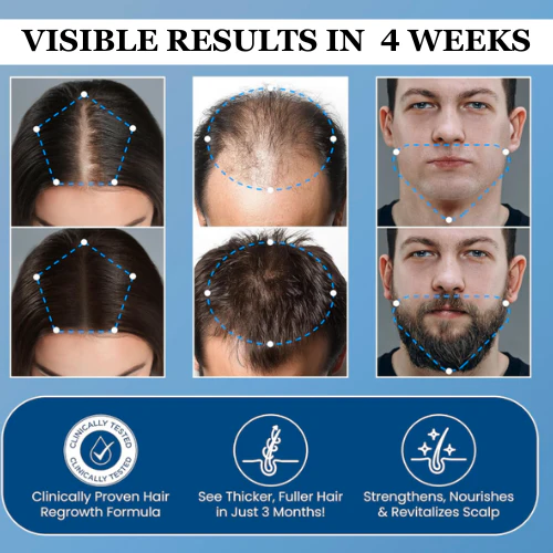 Advanced Hair Growth Roll-On Serum - Image 3