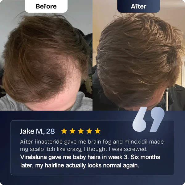 Hair Growth Serum Roll-on - Image 4
