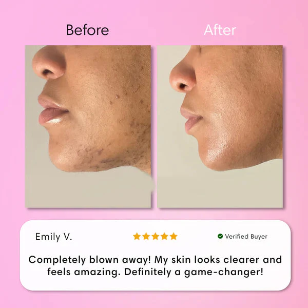 Hair Removal Kit - Image 6