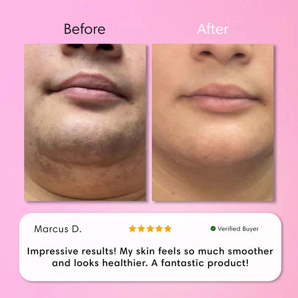 Hair Removal Kit - Image 7