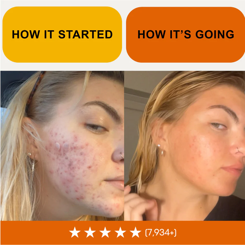 Kill Acne & Redness Ritual - Image 12