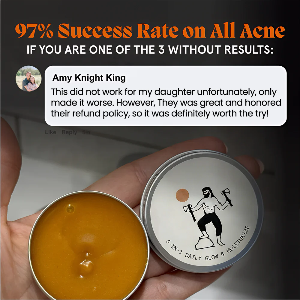 Kill Acne & Redness Ritual - Image 6