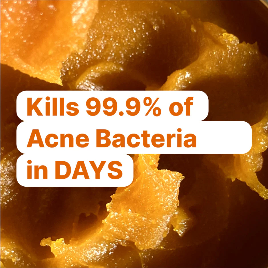 Kill Acne & Redness Ritual - Image 7