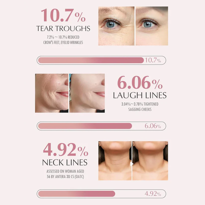 Korean Wrinkle Bounce Multi Balm Stick - Image 4
