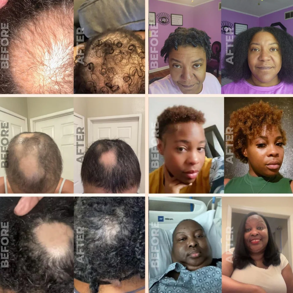 Natural Hair Growth Oil - Image 4