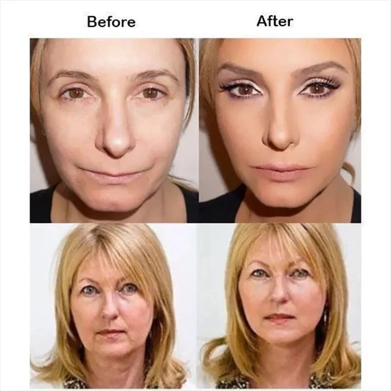 New Ultra Invisible Waterproof Face Lift Stickers Complete Kit - Image 6