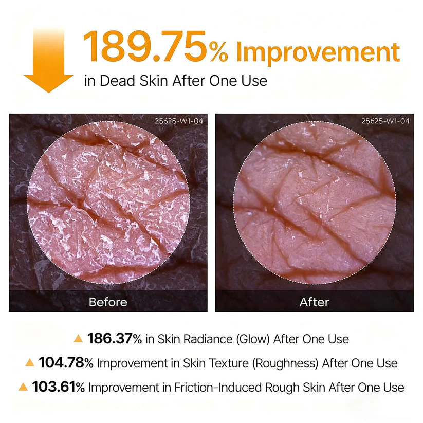 Viralaluna Peel Shot - Kojic + Turmeric Body Peel Spray - Image 4