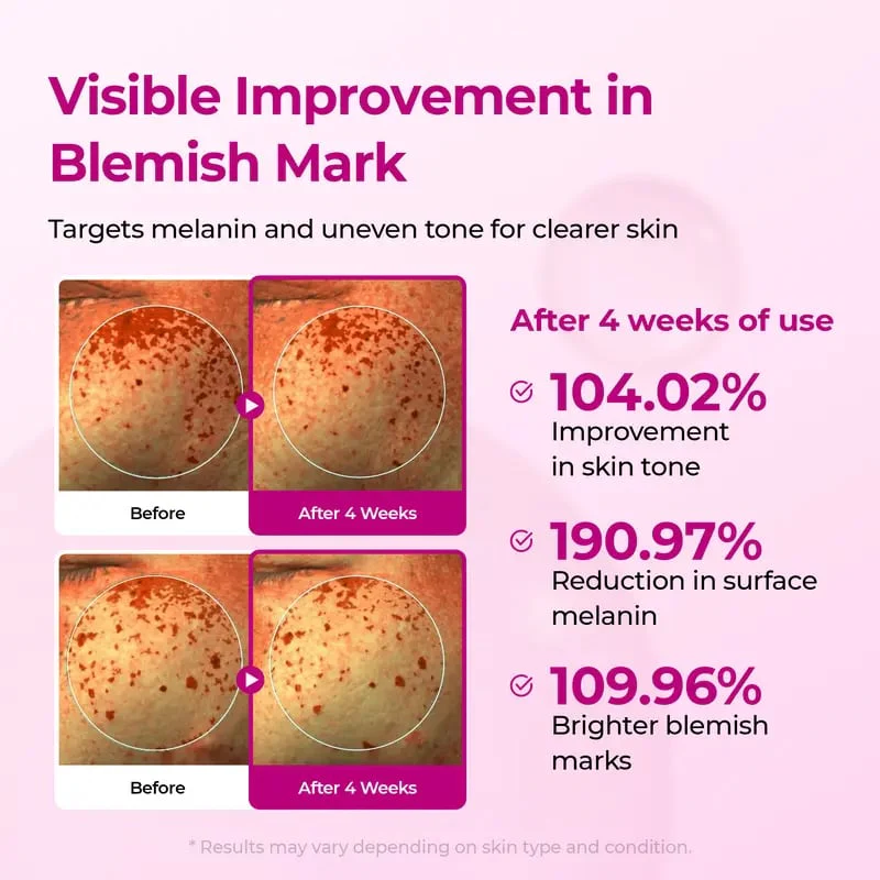 Pore & Spot Care Duo - Image 3