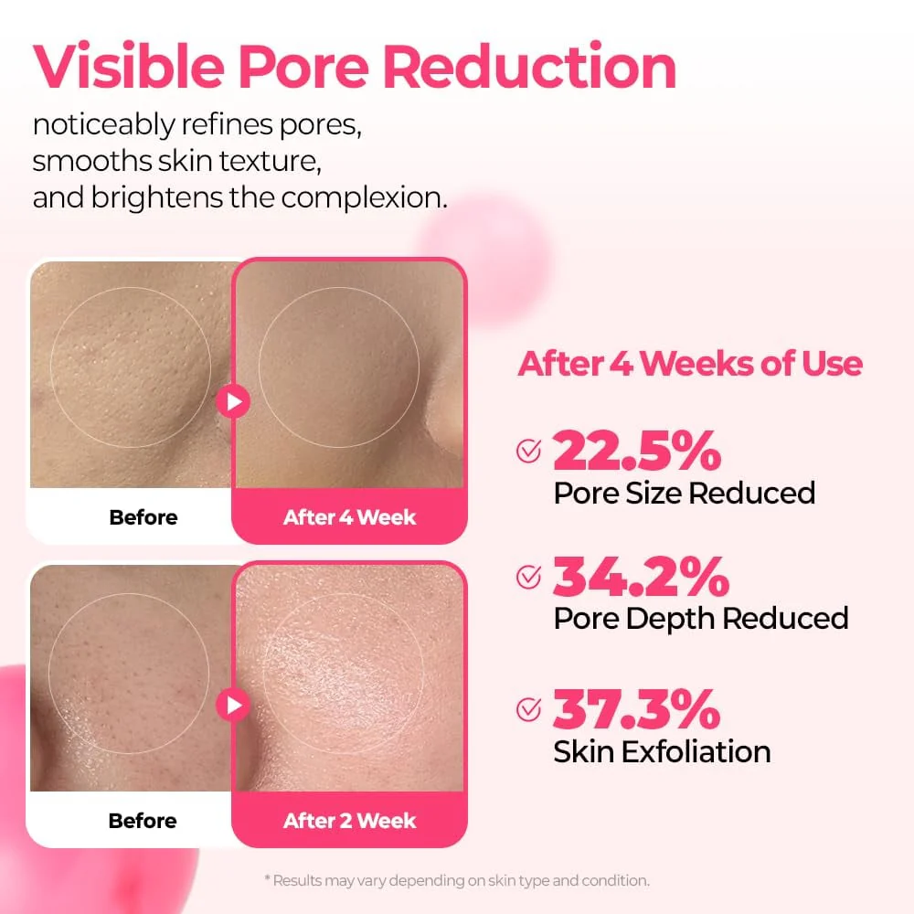 Pore & Spot Care Duo - Image 7