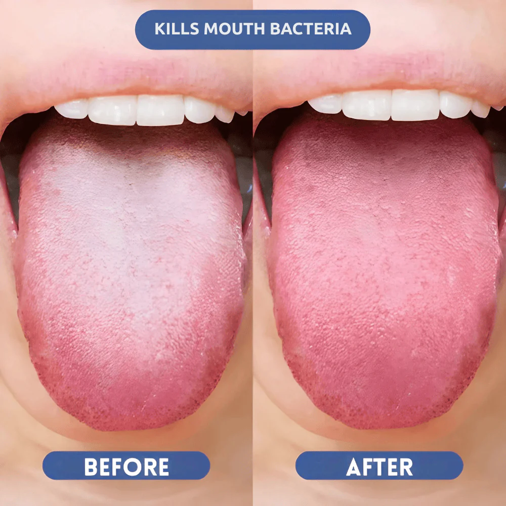 Probiotic Fresh Breath Spray - Image 3