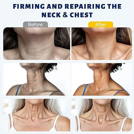 Roller Massage Neck Cream 🧴 Collagen & Hyaluronic Acid | Firms Neck, Reduces Wrinkles & Double Chin - Image 4