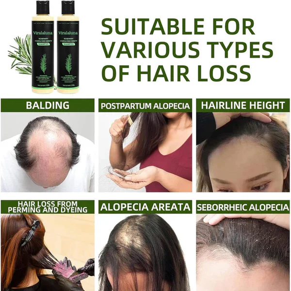 Viralaluna Rosemary Shampoo - Image 6