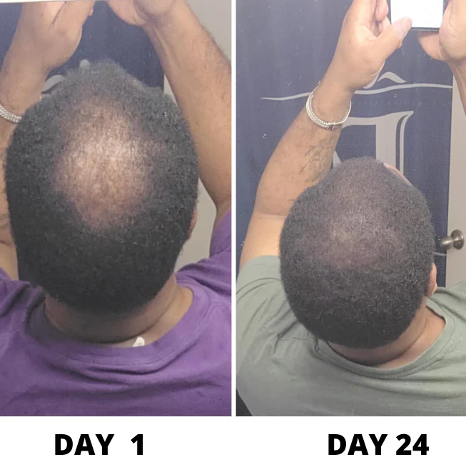Hair Growth Serum-Say Goodbye To Hair Loss - Image 2