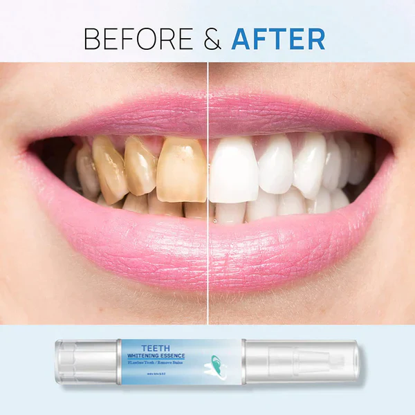 BUY 1 GET 1 FREE | Teeth Whitening Essence - Image 4