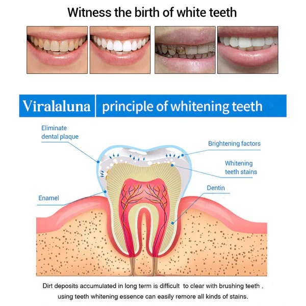 BUY 1 GET 1 FREE | Teeth Whitening Essence - Image 8