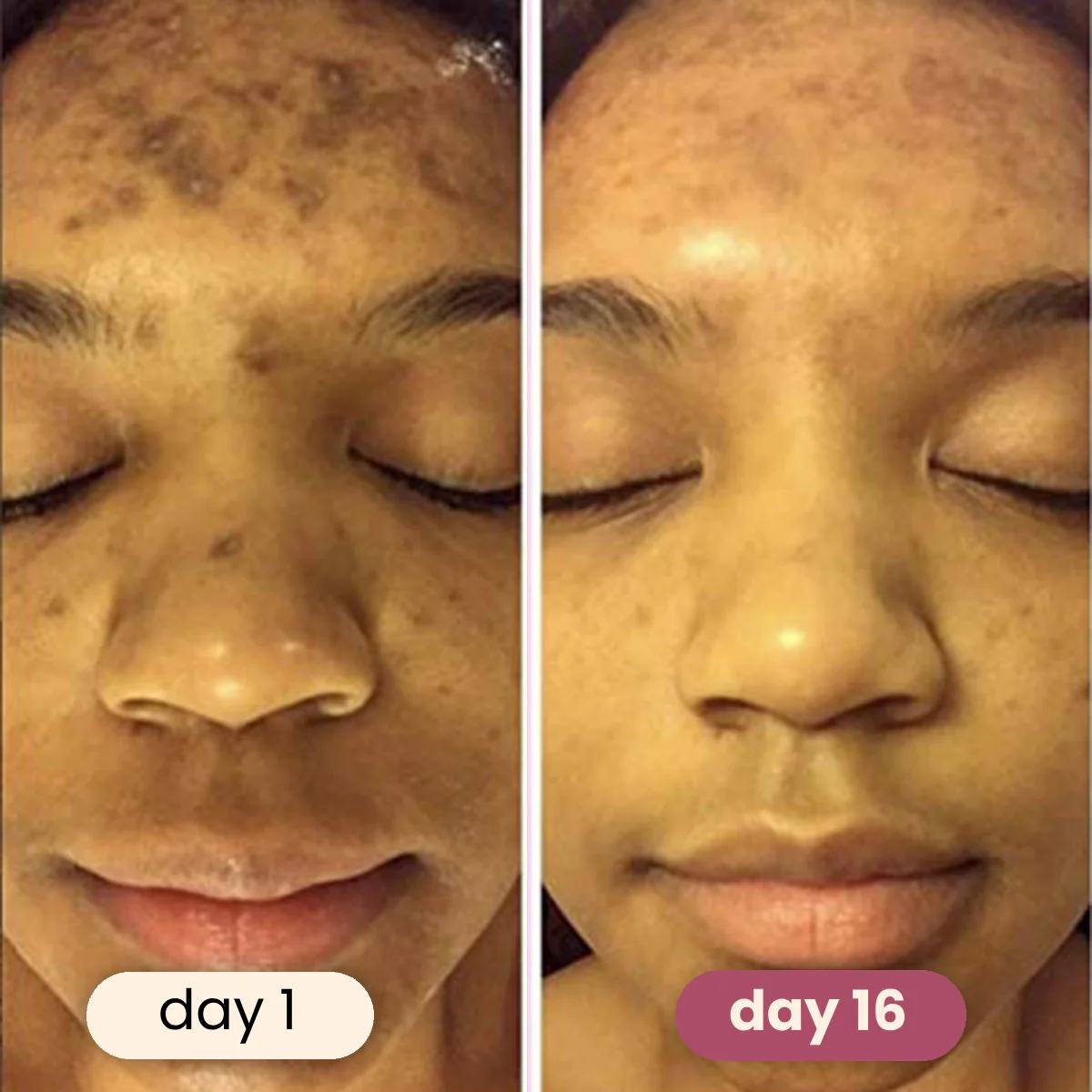 Brightening turmeric & kojic acid pads - Image 2