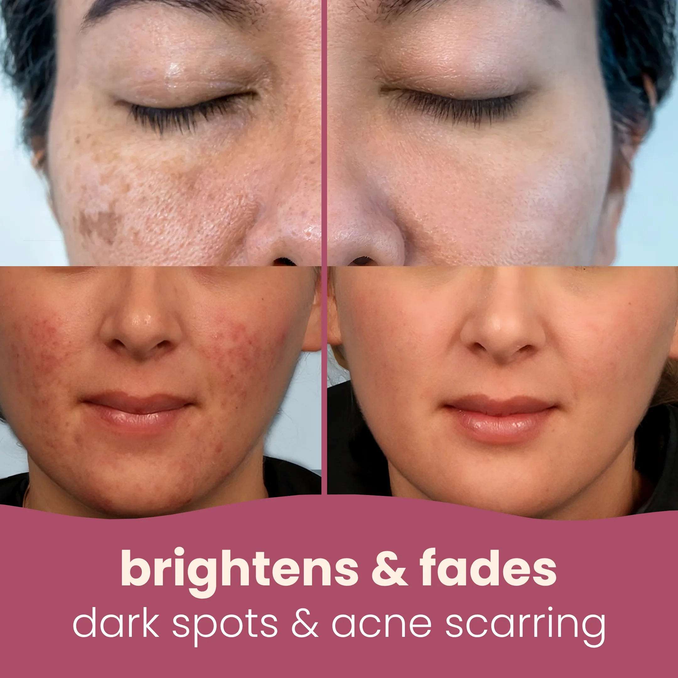 Brightening turmeric & kojic acid pads - Image 4