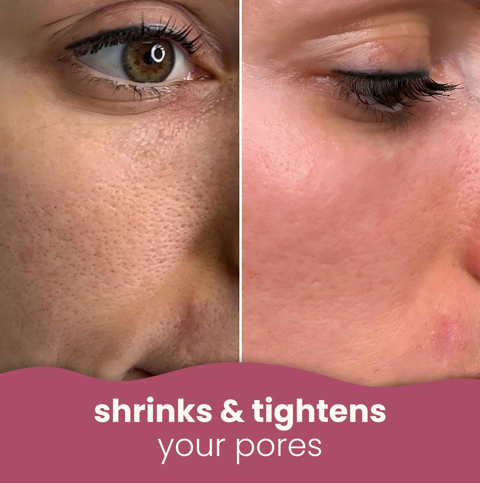 Brightening turmeric & kojic acid pads - Image 7