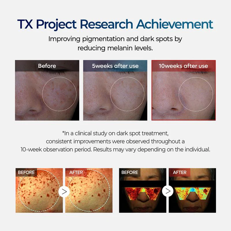 TX Cream – Dark Spot & Hyperpigmentation Corrector - Image 6