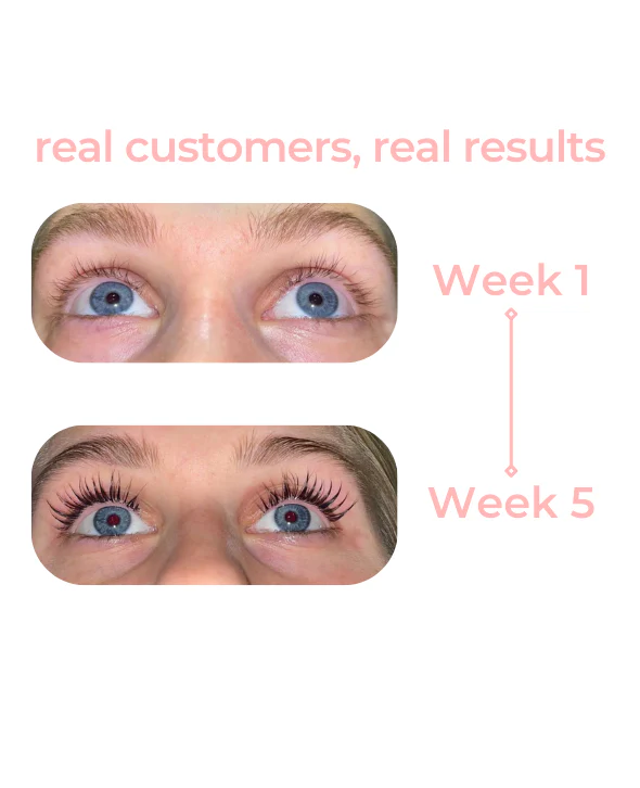Viralaluna Eyelash Growth Serum - Image 5