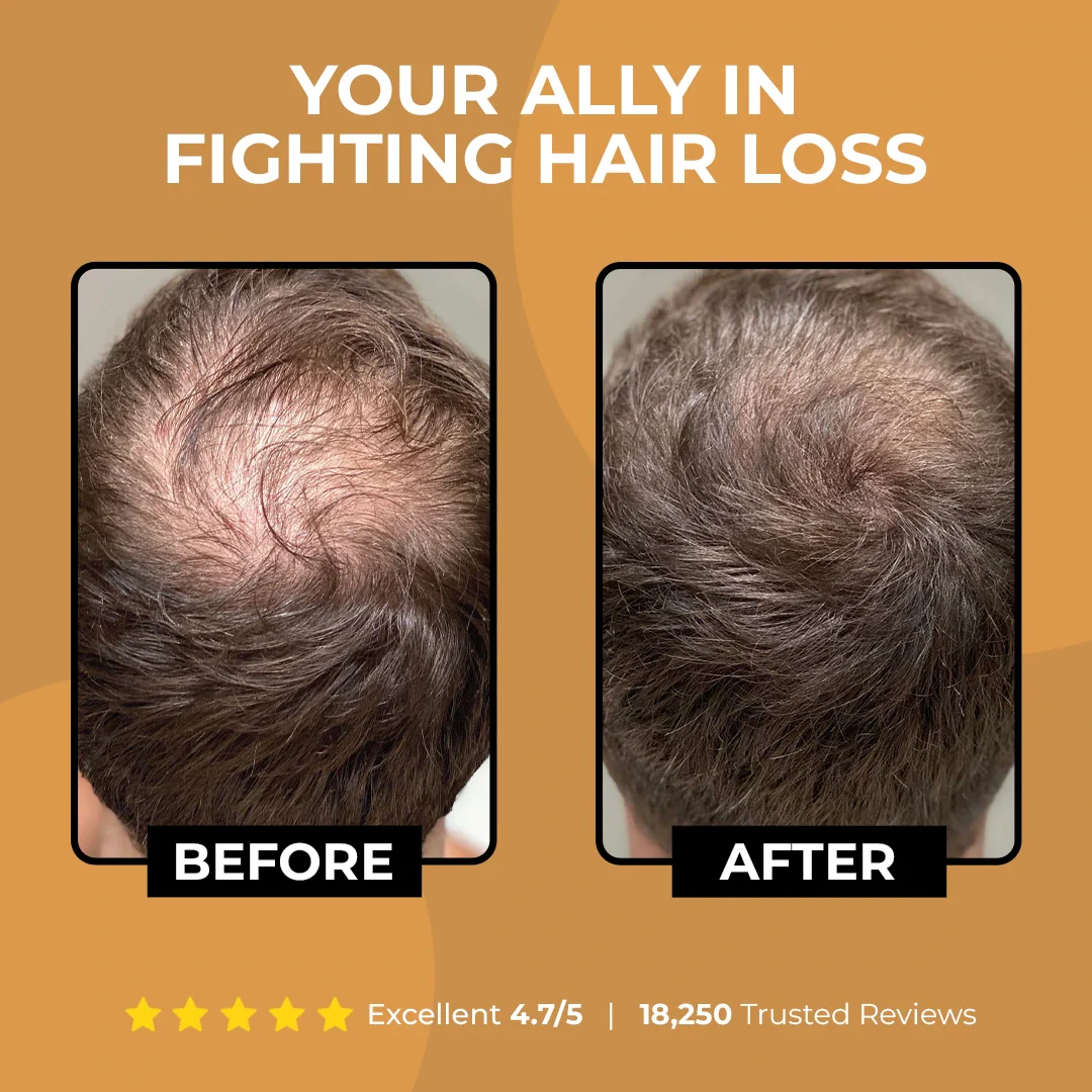 Viralaluna Root Activator Shampoo - Image 4